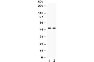 Western blot testing of human 1) HeLa and 2) COLO320 cell lysate with JNK2 antibody. (JNK2 (Alpha/beta) 抗体)