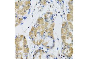 Immunohistochemistry of paraffin-embedded human stomach using STK4 antibody. (STK4 抗体  (AA 303-487))