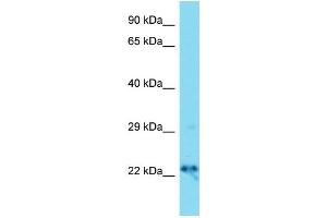 Host: Rabbit  Target Name: Dnajc12  Sample Tissue: Mouse Brain lysates  Antibody Dilution: 1. (DNAJC12 抗体  (Middle Region))