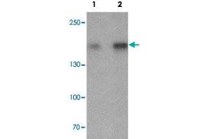 Western blot analysis of Jurkat cell lysate with CRIM2 polyclonal antibody  at (1) 1 and (2) 2 ug/mL. (KCP 抗体  (C-Term))