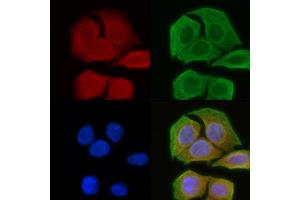 ABIN6258907 and ABIN6274153 staining Hela cells(45 min of heat-shock) by IF/ICC.