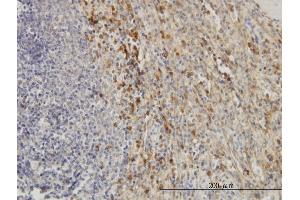 Immunoperoxidase of monoclonal antibody to TIMP2 on formalin-fixed paraffin-embedded human spleen. (TIMP2 抗体  (AA 27-220))