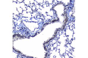 IHC analysis of splicing factor 1 using anti-splicing factor 1 antibody .