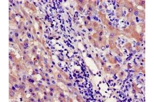 Immunohistochemistry (IHC) image for anti-Cytochrome P450, Family 39, Subfamily A, Polypeptide 1 (CYP39A1) (AA 235-392) antibody (ABIN7142182)