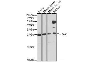 Western blot analysis of extracts of various cell lines using BAK1 Polyclonal Antibody at dilution of 1:1000. (BAK1 抗体)