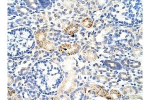RBM4B antibody was used for immunohistochemistry at a concentration of 4-8 ug/ml to stain Epithelial cells of renal tubule (arrows) in Human Kidney. (RBM4B 抗体  (C-Term))