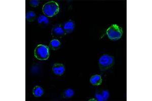 Confocal immunofluorescence analysis of HEK293 cells trasfected with extracellular ROR1 (aa30-406)-hIgGFc using ROR1 mouse mAb (green). (ROR1 抗体  (AA 30-406))