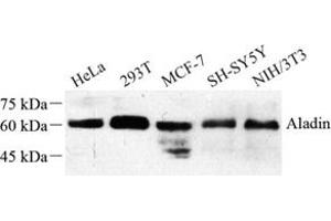 Western blot analysis of Aladin (ABIN7072884) at dilution of 1: 500 (Adracalin 抗体)