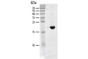 Recombinant BRD4 (44-168) protein gel.