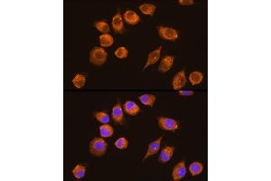 Immunofluorescence analysis of L929 cells using NAGA Rabbit pAb (ABIN6133352, ABIN6144342, ABIN6144343 and ABIN6225273) at dilution of 1:100 (40x lens). (NAGA 抗体  (AA 312-411))
