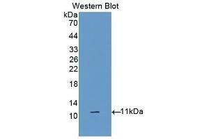 Western Blotting (WB) image for anti-Diazepam Binding Inhibitor (DBI) (AA 2-87) antibody (ABIN1176163) (Diazepam Binding Inhibitor 抗体  (AA 2-87))