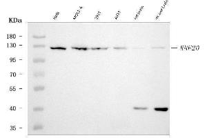 Western blot analysis of RNF20 using anti-RNF20 antibody (ABIN7599859).