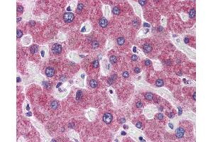 Immunohistochemistry (IHC) image for anti-RHBG (C-Term) antibody (ABIN2783778) (RHBG 抗体  (C-Term))