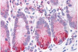 Human Small Intestine: Formalin-Fixed, Paraffin-Embedded (FFPE) (LRRC59 抗体  (N-Term))