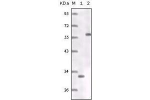 Western Blot showing ER antibody truncated ER recombinant protein (1) MCF-7 cell lysates (2). (Estrogen Receptor alpha 抗体)