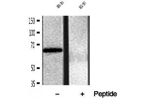 Western blot analysis of extracts of HEK-293 cells, using FKBP65 antibody. (FKBP10 抗体)
