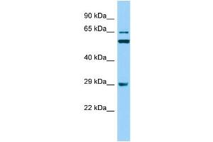 Host: Rabbit Target Name: RAB19 Sample Type: RPMI-8226 Whole Cell lysates Antibody Dilution: 1. (RAB19 抗体  (N-Term))