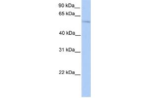 WB Suggested Anti-PLAG1 Antibody Titration:  0. (PLAG1 抗体  (N-Term))