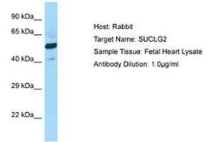 Image no. 1 for anti-Succinate-CoA Ligase, GDP-Forming, beta Subunit (SUCLG2) (AA 258-307) antibody (ABIN6750076) (SUCLG2 抗体  (AA 258-307))