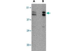 Western blot analysis of FBXL20 in A-20 cell lysate with FBXL20 polyclonal antibody  at (A) 0. (FBXL20 抗体  (C-Term))
