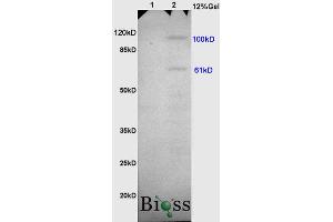 L1 rat heart, L2 rat brain lysates probed (ABIN669636) at 1:200 in 4 °C. (Thrombomodulin 抗体)