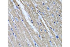 Immunohistochemistry of paraffin-embedded Mouse heart using TNFAIP6 Polyclonal Antibody at dilution of 1:100 (40x lens). (TNFAIP6 抗体)
