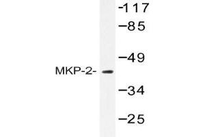 Western blot (WB) analysis of MKP-2 antibody in extracts from RAW264. (DUSP4 抗体)