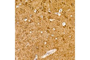 Immunohistochemistry of paraffin-embedded mouse brain using ENO2 Rabbit mAb (ABIN7266959) at dilution of 1:100 (40x lens). (ENO2/NSE 抗体)
