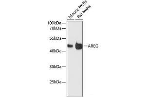 Western blot analysis of extracts of various cell lines using AREG Polyclonal Antibody at dilution of 1:3000. (Amphiregulin 抗体)