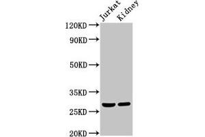 Western Blot Positive WB detected in: Jurkat whole cell lysate, Rat kidney tissue All lanes: MSX2 antibody at 2 μg/mL Secondary Goat polyclonal to rabbit IgG at 1/50000 dilution Predicted band size: 29 kDa Observed band size: 29 kDa (Msx2/Hox8 抗体  (AA 50-120))