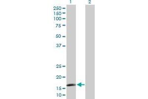 Western Blot analysis of CAMP expression in transfected 293T cell line by CAMP MaxPab polyclonal antibody. (Cathelicidin 抗体  (AA 31-170))