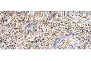 Immunohistochemistry of paraffin-embedded Human brain tissue using SAV1 Polyclonal Antibody at dilution of 1:90(x200) (SAV1 抗体)