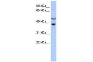 Image no. 1 for anti-Suppressor of Cytokine Signaling 7 (SOCS7) (AA 35-84) antibody (ABIN6743758) (SOCS7 抗体  (AA 35-84))