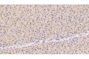 Detection of OAS1 in Human Liver Tissue using Monoclonal Antibody to 2',5'-Oligoadenylate Synthetase 1 (OAS1) (OAS1 抗体  (AA 74-165))
