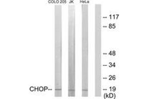 Western blot analysis of extracts from HeLa/Jurkat/COLO205 cells, using CHOP (Ab-30) Antibody. (DDIT3 抗体  (AA 15-64))