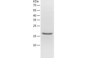 Western Blotting (WB) image for Regulator of G-Protein Signaling 10 (RGS10) (AA 1-181) protein (His tag) (ABIN7124813) (RGS10 Protein (AA 1-181) (His tag))