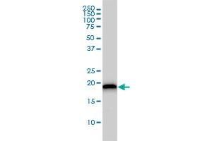 UBE2M monoclonal antibody (M01), clone 3C4 Western Blot analysis of UBE2M expression in Jurkat . (UBE2M 抗体  (AA 1-183))