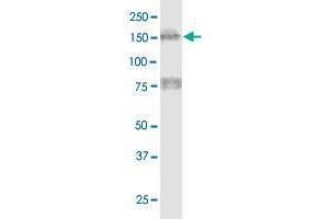 MTUS1 monoclonal antibody (M01), clone 1C7.
