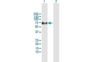 Western Blot analysis of KLHDC4 expression in transfected 293T cell line by KLHDC4 MaxPab polyclonal antibody. (KLHDC4 抗体  (AA 1-520))