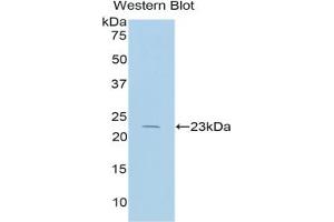Western blot analysis of the recombinant protein. (IL17 Receptor B 抗体  (AA 166-354))