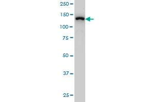 SF3B2 monoclonal antibody (M01), clone 5D2 Western Blot analysis of SF3B2 expression in Hela S3 NE . (SF3B2 抗体  (AA 592-645))