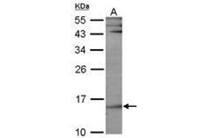 Image no. 1 for anti-Ubiquitin-Conjugating Enzyme E2B (UBE2B) (AA 7-152) antibody (ABIN467405) (UBE2B 抗体  (AA 7-152))