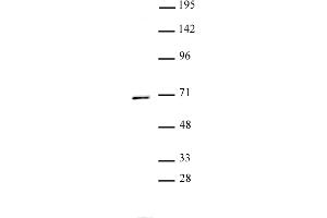PPM1D antibody (pAb) tested by Western blot.