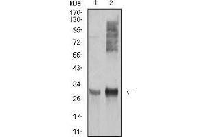 Western blot analysis using HLA-DRA mouse mAb against Ramos (1), and Raji (2) cell lysate. (HLA-DRA 抗体  (AA 26-254))