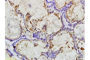 Immunohistochemistry (IHC) image for anti-Carcinoembryonic Antigen Gene Family (CEA) antibody (ABIN722946) (CEA 抗体)