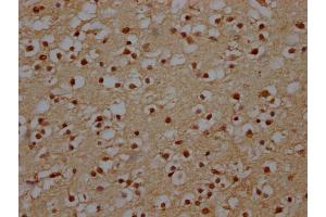 IHC image of ABIN7151088 diluted at 1:140 and staining in paraffin-embedded human brain tissue performed on a Leica BondTM system. (NHLRC1 抗体  (AA 86-395))