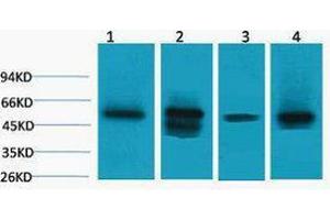 Western Blotting (WB) image for anti-Lactate Dehydrogenase D (LDHD) antibody (ABIN3181365) (LDHD 抗体)