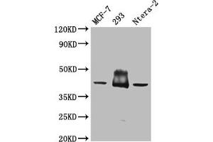 Western Blot Positive WB detected in: Mouse brain tissue All lanes: S1PR2 antibody at 3 μg/mL Secondary Goat polyclonal to rabbit IgG at 1/50000 dilution Predicted band size: 39 kDa Observed band size: 39 kDa (S1PR2 抗体  (AA 293-353))