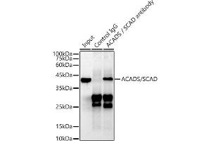 Immunoprecipitation analysis of 600 μg extracts of Mouse liver cells using 3 μg ACADS / SCAD antibody (ABIN7265419). (ACADS 抗体)