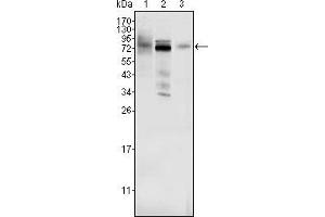 Western blot analysis using MDM4 mouse mAb against Hela (1), A549 (2) and A431 (3) cell lysate. (MDM4-binding Protein 抗体)